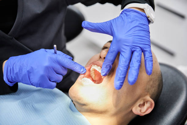 Best Emergency Wisdom Teeth Removal in Elmore, AL