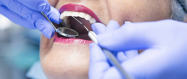 Best Emergency Dental Care for Broken or Chipped Teeth in Elmore, AL
